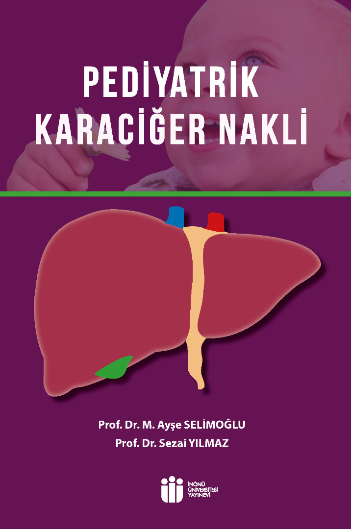 Pediyatrik Karaciğer Nakli