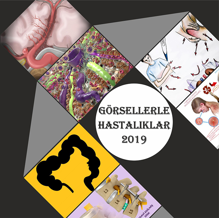 Görsellerle Hastalıklar 2019